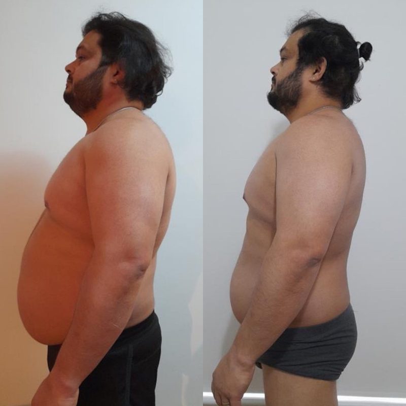 Male client side profile showing major weight loss and belly fat reduction transformation