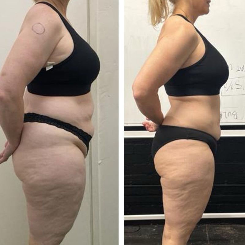 Female client midsection fat loss before and after – tighter waistline with Strength Lab coaching